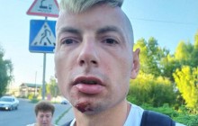 В Чернигове неизвестные избили журналиста