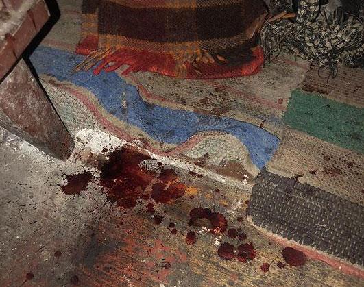 Внаслідок отриманих травм померла жінка / фото ГУНП в Чернігівській області