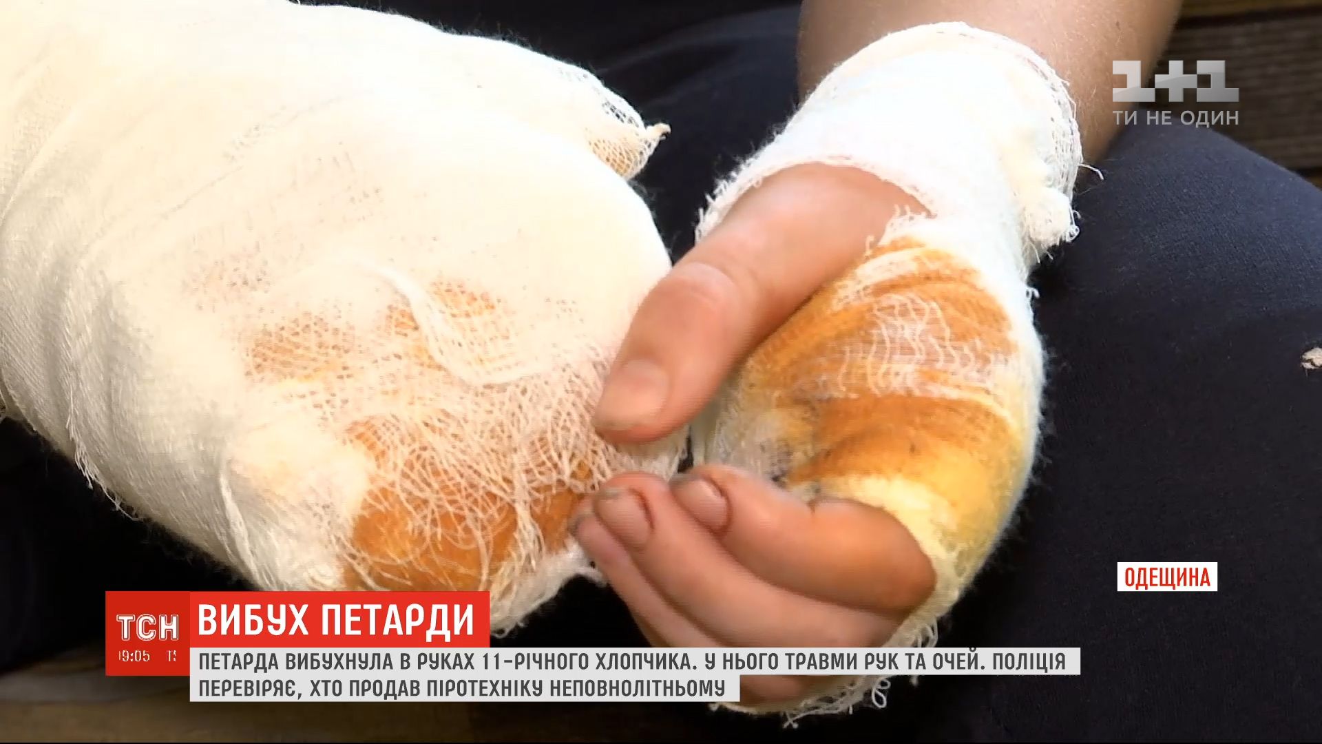 Обставини травмування хлопчика з’ясовує поліція / скріншот Обставини травмування хлопчика з’ясовує поліція / скріншот