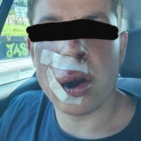 Ukraine student brutally beaten, knocked unconscious during allegedly xenophobic attack in Poland (Photo)