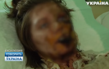 История с мужчиной из Запорожья, залившем в рот своей сожительнице кипяток, получила продолжение (видео)