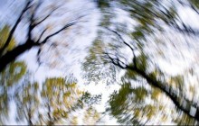 Врач объяснила, почему возникает головокружение