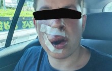 Ukraine student brutally beaten, knocked unconscious during allegedly xenophobic attack in Poland (Photo)