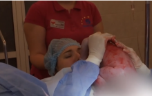 В Украине провели уникальные роды