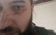 "Дівчині порвали вухо, нас відпиз**ли": Міноборони РФ запустило "БДСМ-курси" для військкорів