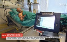 Впервые в Украине пациенту вживили искусственное мини-сердце (видео)