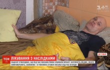 Для чоловіка сеанс масажу закінчився госпіталізацією: є підозра на зламаний хребет (відео)