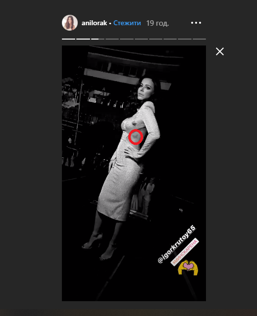 Скріншот відео сторіс Лорак / instagram.com/anilorak/ Скріншот відео сторіс Лорак / instagram.com/anilorak/