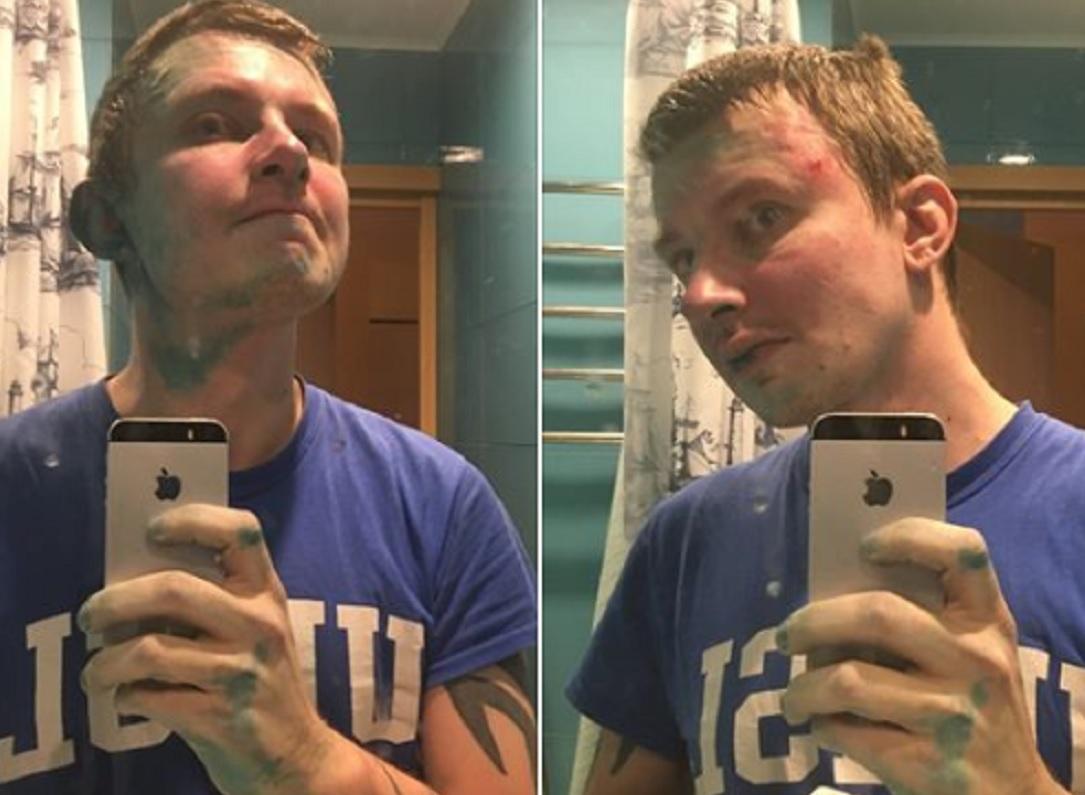 Левієв отримав удари в щелепу та легкі травми після падіння / facebook.com/ruslanleviev Левієв отримав удари в щелепу та легкі травми після падіння / facebook.com/ruslanleviev