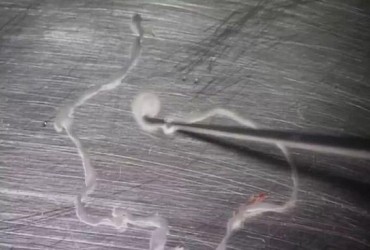 В Японії з горла жінки видалили живого хробака після того, як вона їла сиру рибу