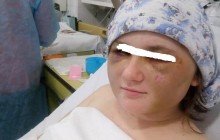Бив ногами і палицею: у Херсоні дівчина потрапила до реанімації після побиття колишнім хлопцем