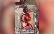 В США врачи вернули к жизни мертвое сердце (видео)
