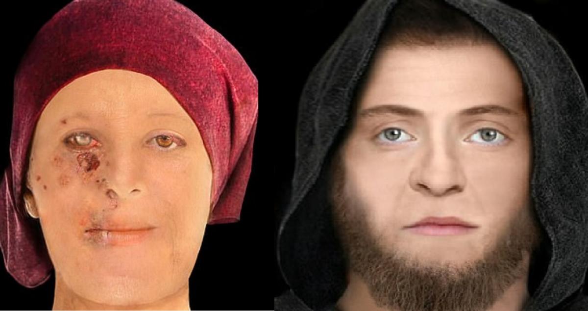 Жінка була частково осліплена через проказу / dailymail.co.uk Жінка була частково осліплена через проказу / dailymail.co.uk