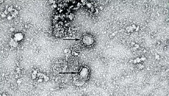 Снимок коронавируса , полученное с помощью электронного микроскопа / The Chinese disease prevention authority