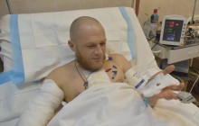 "Куля розірвала артерію": у Дніпрі врятували пораненого снайпером українського бійця (фото)