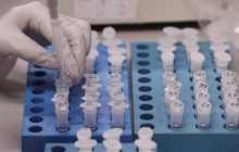 Быстрые тесты на выявление коронавируса поступят в Украину 10 марта - Минздрав