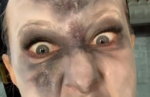 "Ускладнення після коронавірусу": Собчак шокувала мережу "істинним обличчям" (відео)