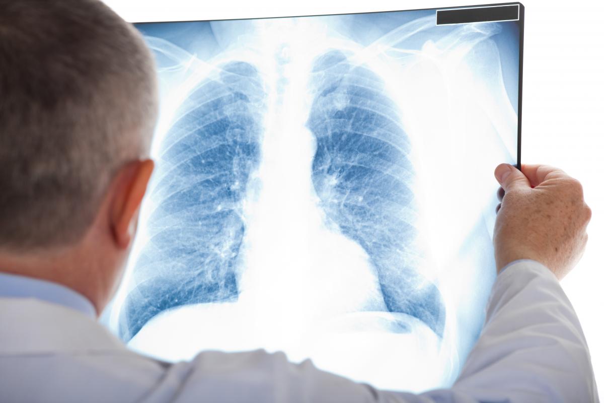 За словами лікаря Катерини Булавінової, комп’ютерну томографію легень при зараженні робити не треба / ua.depositphotos.com