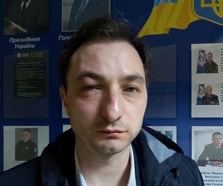 Головного лікаря Інституту раку Андрія Безносенка побили невідомі / Фото: Facebook.com/beznosenko.andriy Головного лікаря Інституту раку Андрія Безносенка побили невідомі / Фото: Facebook.com/beznosenko.andriy