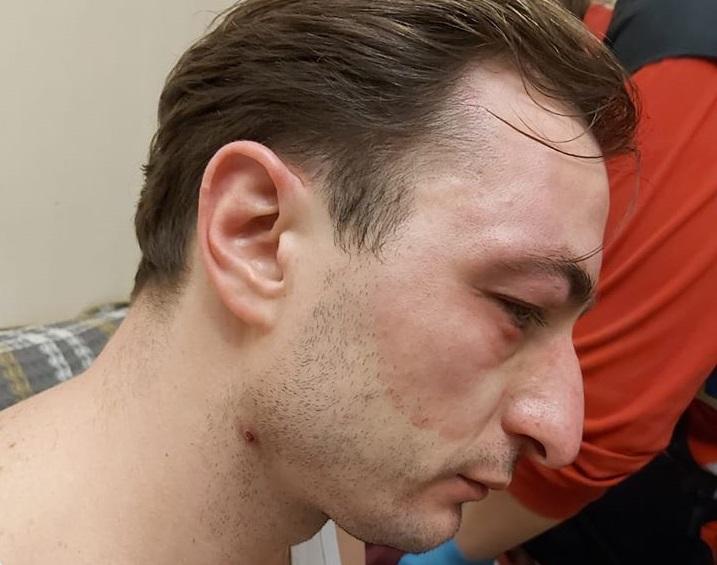 Головного лікаря Інституту раку Андрія Безносенка побили невідомі / Фото: Facebook.com/beznosenko.andriy