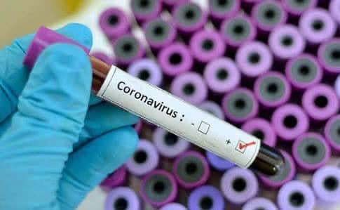 20 марта в Украине зафиксировано 26 случаев заболевания коронавирус / facebook.com/koda.gov.ua