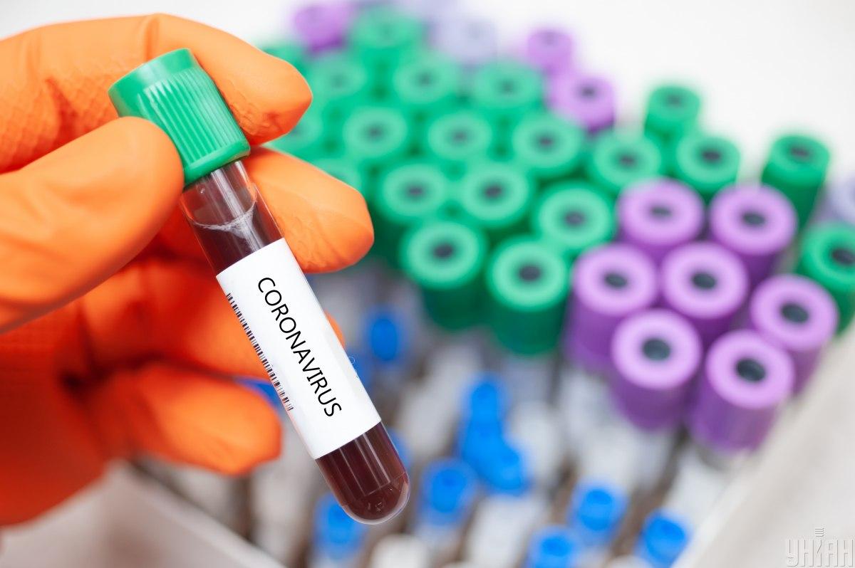 По состоянию на утро 25 марта в области официально подтверждено 22 случая инфицирования коронавирусом / фото УНИАН