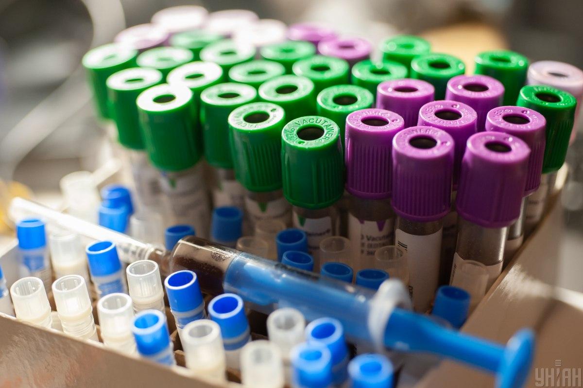 За предыдущие сутки всего было сделано 55 тыс. 503 тестирования на коронавирус / фото УНИАН