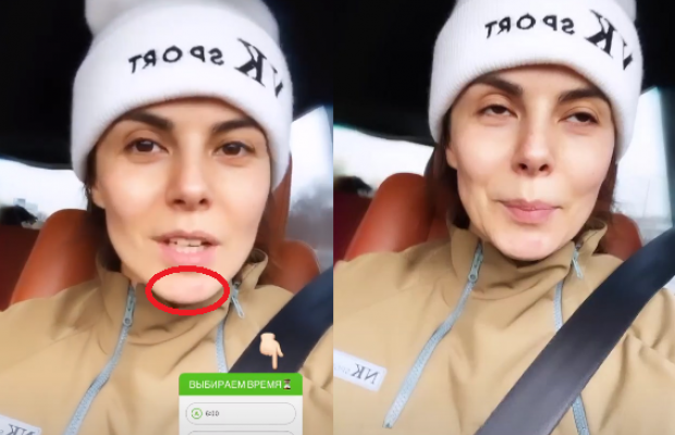 Настя Каменських без макіяжу засвітила прищі на обличчі (фото)
