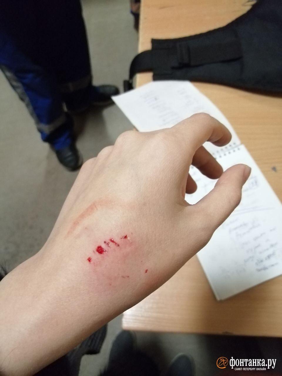 Журналистке сделали укол от столбняка / фото: Фонтанка Журналистке сделали укол от столбняка / фото: Фонтанка