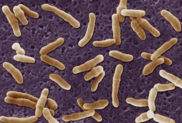 Украине грозят вспышки дифтерии и холеры, уже зафиксированы случаи – инфекционист