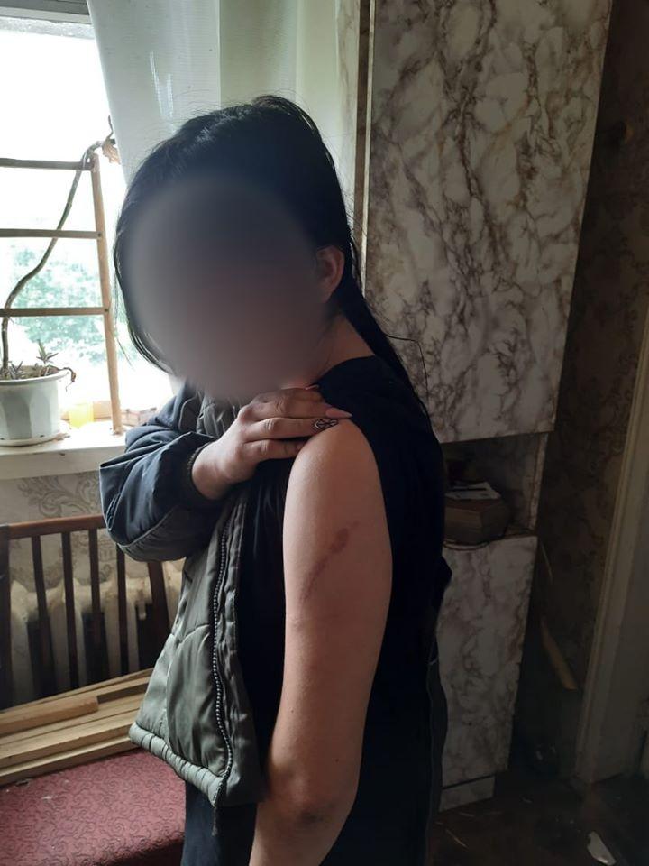 Девочку держала на цепи родная мать / фото полиция Луганской области Девочку держала на цепи родная мать / фото полиция Луганской области