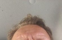 Побиття керівництва парку «Тузловські лимани»: відкрили три кримінальні справи