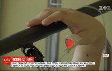 Мати звернулася до лікарів лише за добу: у Львові рятують шестирічного хлопчика з опіками чверті тіла (відео)