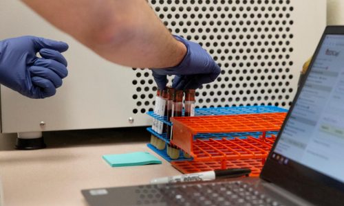 Nature Ученые нашли доказательства, что антитела защищают от повторного заражения COVID: