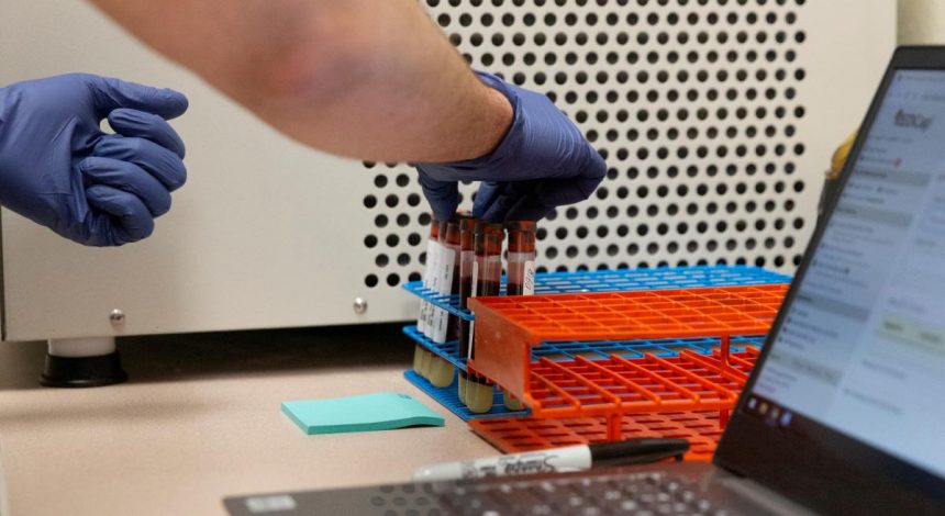 В мире болезнь COVID-19 преодолели более 7,3 миллиона человек