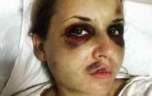 Избиение в поезде "Мариуполь - Киев": самочувствие потерпевшей ухудшилось