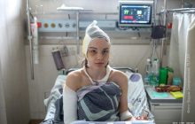 Шок, розрив печінки та синці по всьому тілу: ЗМІ показали наслідки звірств силовиків в Білорусі (фото 18+)