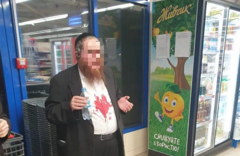 Хасиду розбили носа / фото JewishNews Хасиду розбили носа / фото JewishNews