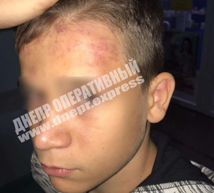 Полиция сняла побои / фото Днепр оперативный Полиция сняла побои / фото Днепр оперативный
