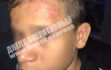 Били и душили: на Днепропетровщине дети-ромы напали под школой на 12-летнего мальчика