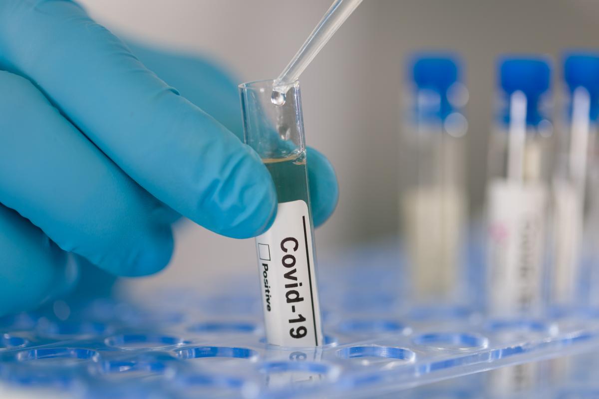 Лаборатории за сутки сделали 96 947 тестов на коронавирус / фото ua.depositphotos.com
