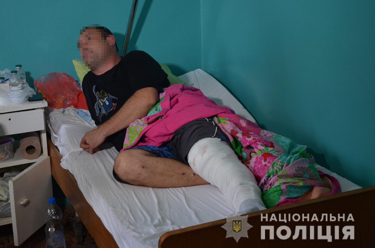 Пострадавший получил огнестрельное ранение ноги / фото полиции Житомирской области