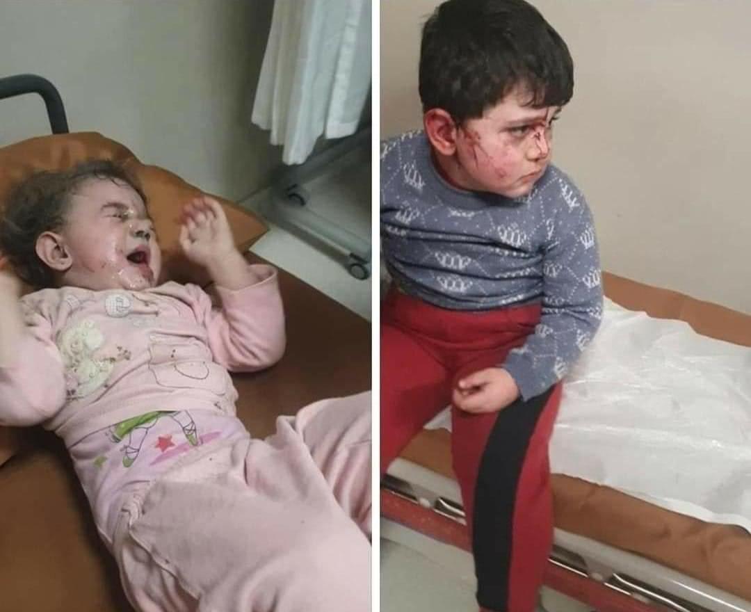 При обстрілі Гянджі в Азербайджані постраждали діти / Twitter, MFA Azerbaijan При обстрілі Гянджі в Азербайджані постраждали діти / Twitter, MFA Azerbaijan