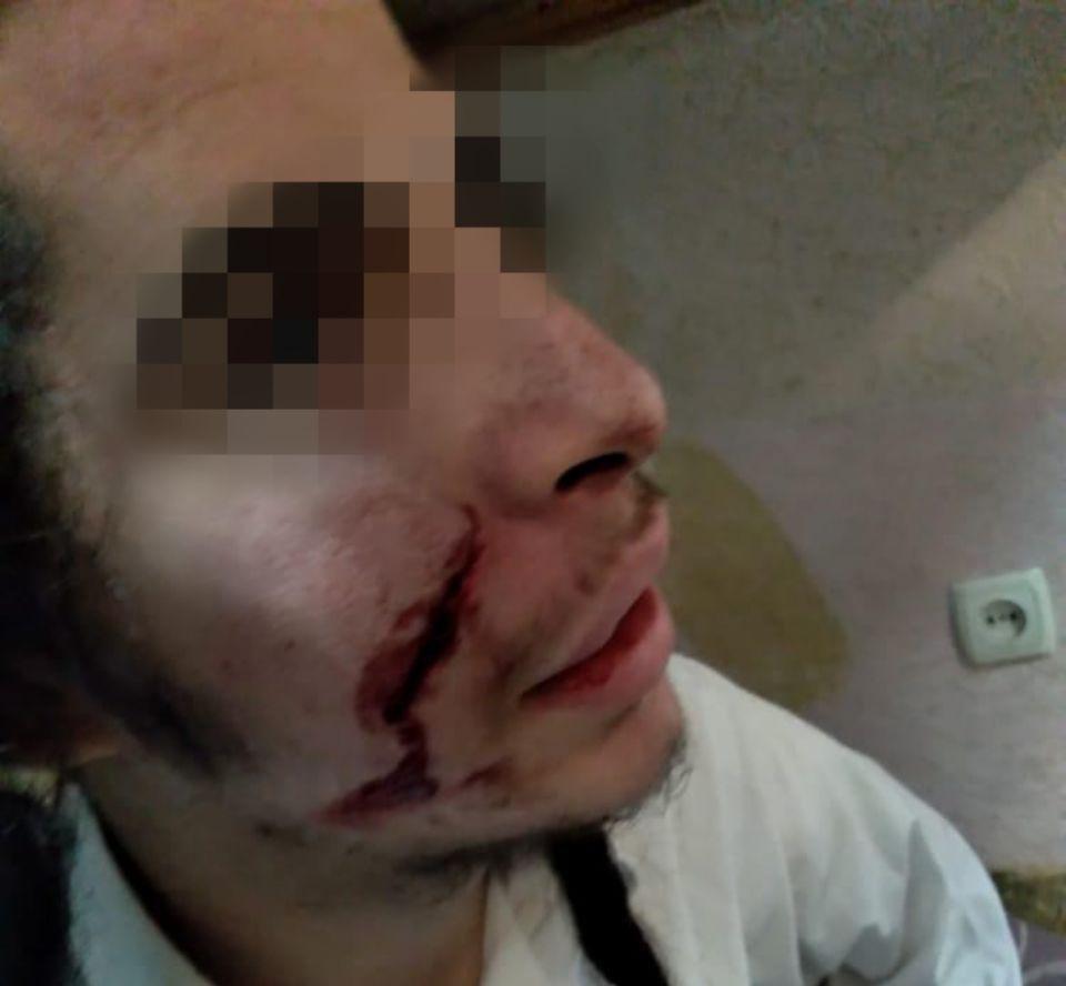 Three men with a knife attacked a Bratslav Hasid in Uman Three men with a knife attacked a Bratslav Hasid in Uman