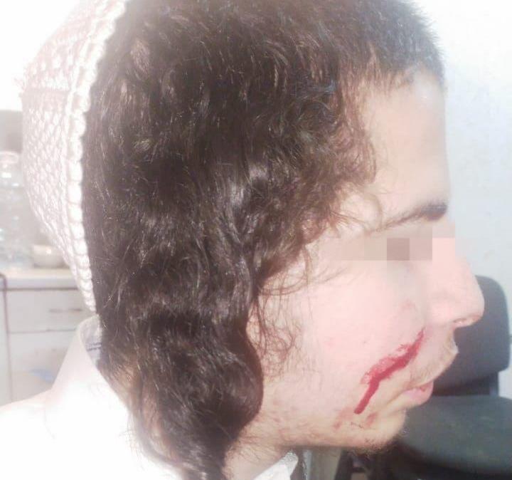 Three men with a knife attacked a Bratslav Hasid in Uman Three men with a knife attacked a Bratslav Hasid in Uman