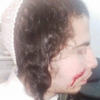 Three men with a knife attacked a Bratslav Hasid in Uman