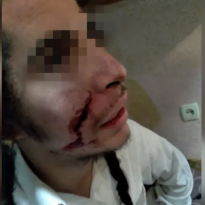 Man who attacked a Hasid with knife detained in Uman