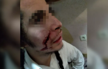 Man who attacked a Hasid with knife detained in Uman