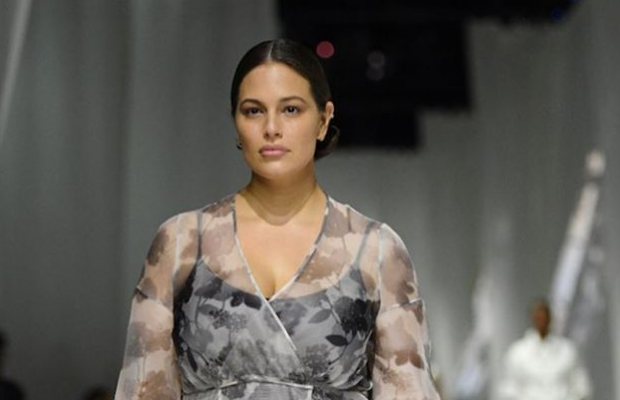 Відома модель засвітила моторошні розтяжки на животі