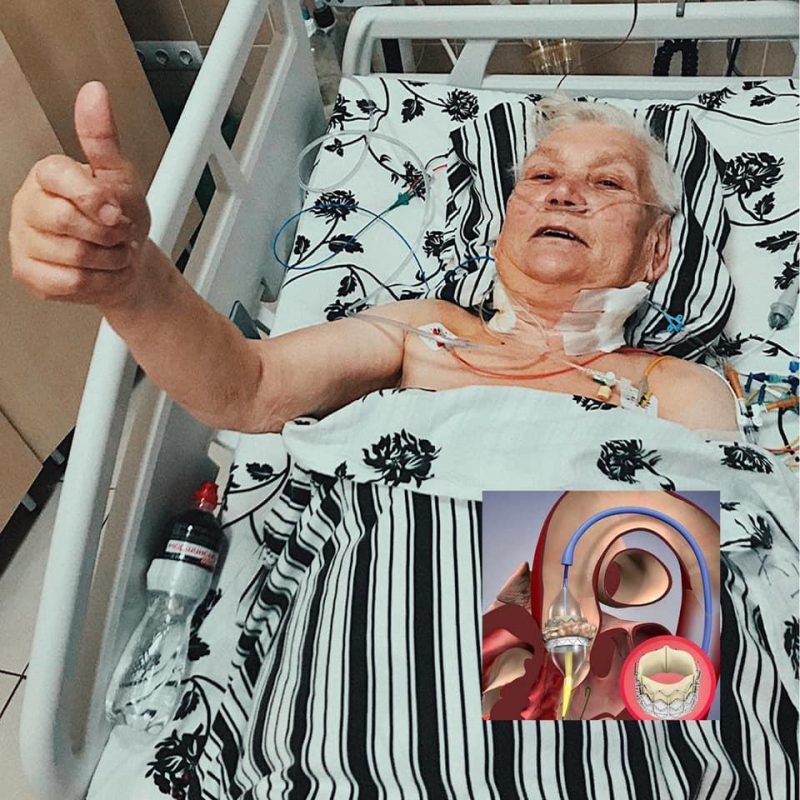 Женщина, которой сделали уникальную операцию / фото facebook.com/ulyana.samchuk